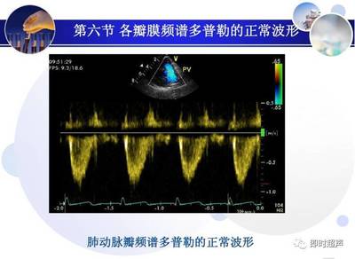 正常心臟超聲診斷中頻譜監測技術的研究與應用進展